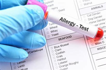 Allergy Tests Image