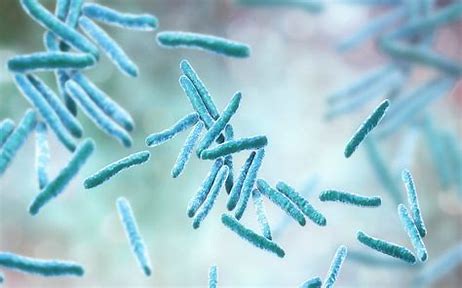 Mycobacteria PCR Image