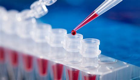 PCR Testing Image