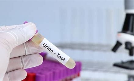 Urine Tests Image